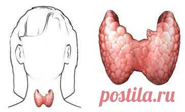 Тиреоидэктомия - Удаление щитовидной железы - Операции и процедуры - описание, методика проведения, восстановление