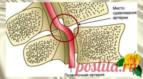 Помогите своей шее, потому что она защищает вас! - Волшебство Жизни