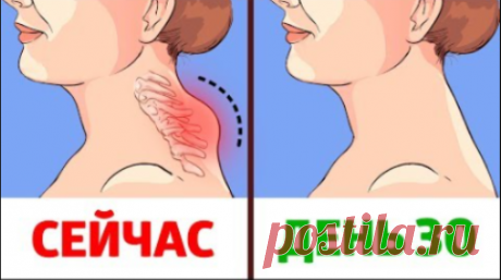 Как убрать горб на шее. Прежде всего, вам нужно избавиться от мягкой постели: и матрас, и подушка должны быть средней жёсткости. Спать нужно так, чтобы позвоночник был прямым. Это можно сделать только в том случае, если вы будете спать на полу. Попробуйте, и вы убедитесь, что это совсем не трудно. Конечно, на полу холодно спать, но это лучше, чем спать на мягкой постели. Чтобы облегчить себе задачу, под голову подкладывайте не подушку, а свернутое в валик полотенце. Вы должны научиться спать т…