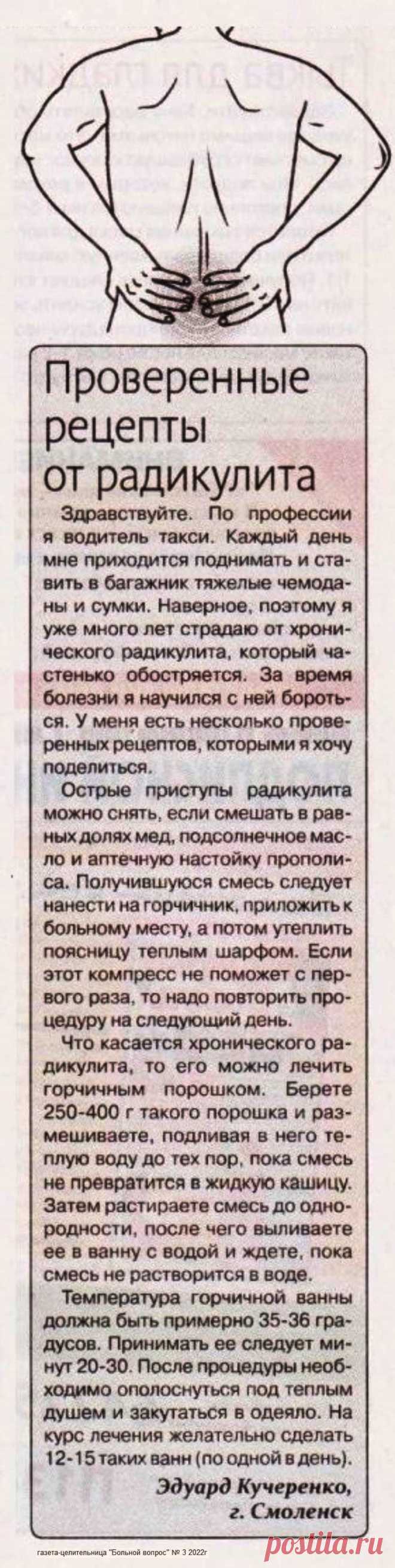 Проверенные рецепты от радикулита