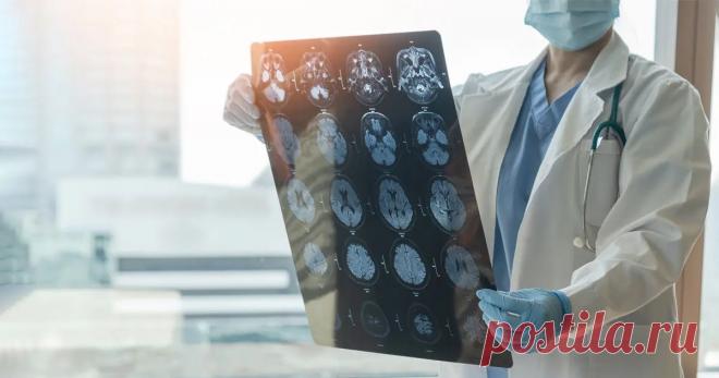 Ученые: Здоровье мозга зависит от 12 факторов Специалисты Американской академии неврологии рассказали, что защитить мозг от преждевременного старения и различных заболеваний могут 12 факторов, связанных со здоровыми привычками и образом жизни.