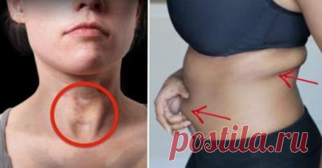 8 признаков проблем со щитовидной железой, о которых вы никогда бы не подумали Часто, когда мы чувствуем себя плохо, мы просто двигаемся дальше как обычно. Хотя это может быть правдой, что вы в порядке, иногда незначительные симптомы в вашем теле могут указывать на большие медиц…