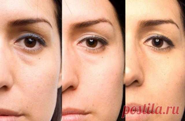 8 способов, благодаря которым ваши глаза будут выглядеть на 10 лет моложе Проверенные методы! Яркие и красивые глаза являются важнейшим отличием молодежи. К сожалению, по мере взросления людей глаза часто показывают первые