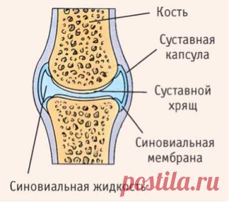 Артрозы, Артриты