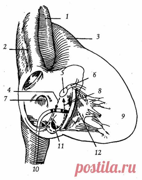 Катетерная аблация (деструкция), Лечение нарушений ритма и проводимости, CardioSchool