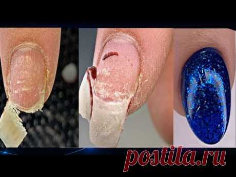 Жуткая отслойка😱Наращивание на ослабленный ноготь💅Идеальный маникюр на сухой кутикуле - YouTube