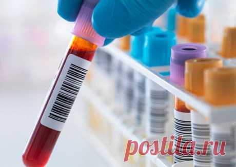 Врачи бьют тревогу: диабет выходит в лидеры по заболеваемости // KP.RU