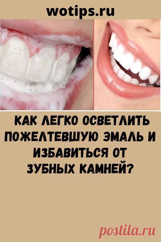 Как легко осветлить пожелтевшую эмаль и избавиться от зубных камней?