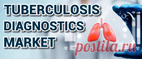 Tuberculosis [TB] Diagnostics Market Size, Share | Growth, 2029