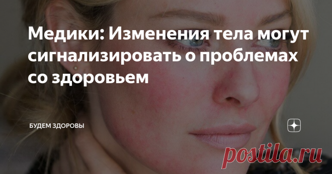 Медики: Изменения тела могут сигнализировать о проблемах со здоровьем Медики изучили данные многих людей, страдающих от различных болезней. Они рассказали, какие изменения тела могут сигнализировать о возникших проблемах в организме человека, отметив, что их нельзя игнорировать.
Если на протяжении нескольких дней на лице имеются отеки век, нужно пройти обследование, чтобы вовремя предупредить развитие болезней почек, сердца или печени. Верхние веки указывают, что жи
