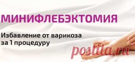 Что такое минифлебэктомия: основные понятия и показания к проведению процедуры