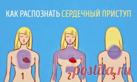 Как распознать сердечный приступ за месяц до того, как он случится