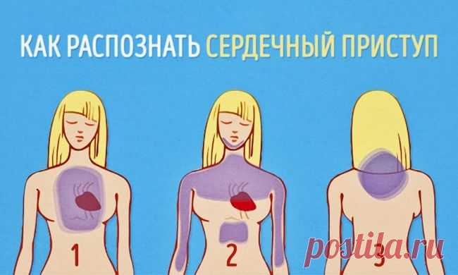 Как распознать сердечный приступ за месяц до того, как он случится