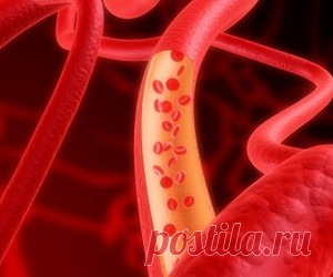 7 простых способов очистить сосуды - health info