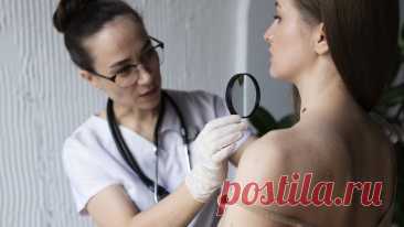 Обычный вирус оказался скрытым возбудителем рака NEJM: вирус папилломы способен встраиваться в ДНК клеток и вызывать рак кожи.