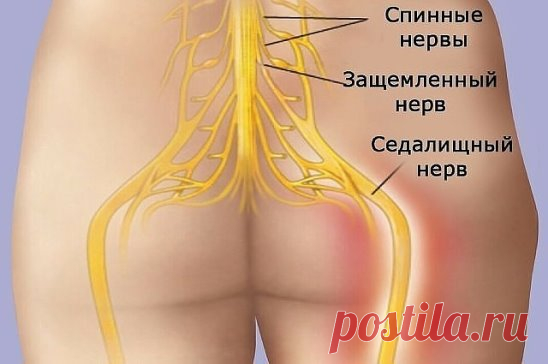 КАК РАЗБЛОКИРОВАТЬ СЕДАЛИЩНЫЙ НЕРВ
Как разблокировать седалищный нерв: 2 простых способа снять боль
Седалищный нерв свое начало берет в поясничном отделе позвоночника и, проходя через ягодицы, тянется к ступне. Поэтому боль при его защемлении чувствуется особенно сильно. 
Как правило, термин «защемление/ущемление седалищного нерва» подразумевает потерю эластичности и гибкости мышц задней поверхности ноги. Это часто связано с процессом возрастного укорочения (ригидности) мышц, который может начат