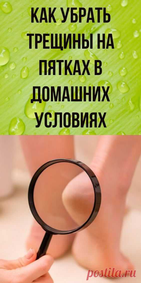 Как убрать трещины на пятках в домашних условиях