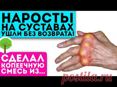 Врач был в шоке, когда увидел мои руки! За 10 процедур суставы стали как новенькие!