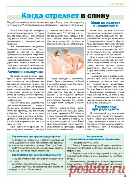 Радикулит