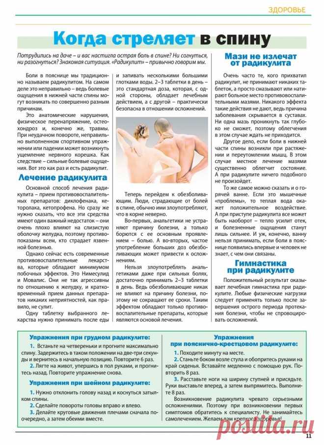 Радикулит