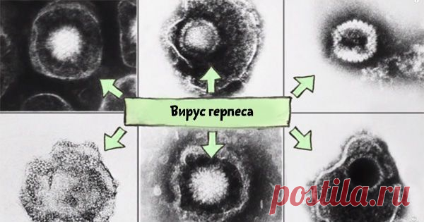 Вирус герпеса