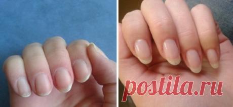 Как быстро отрастить ногти, которые никогда не сломаются: поможет простое средство из 4 компонентов! - Что хочет женщина