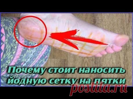 Проще не придумаешь Вот что произойдет, если нанести немного ЙОДА НА ПЯТКИ Польза для здоровья - YouTube