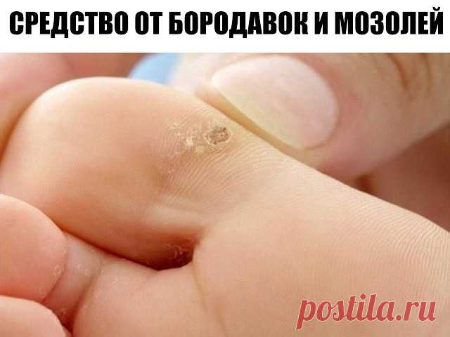 (76) Одноклассники