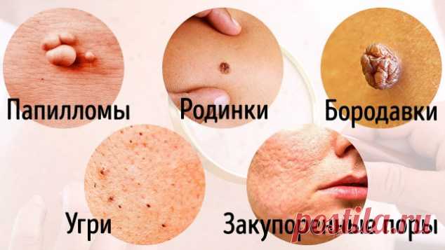 8 Серьезных Заболеваний, о Которых Говорит Наша Кожа — Копилочка полезных советов
