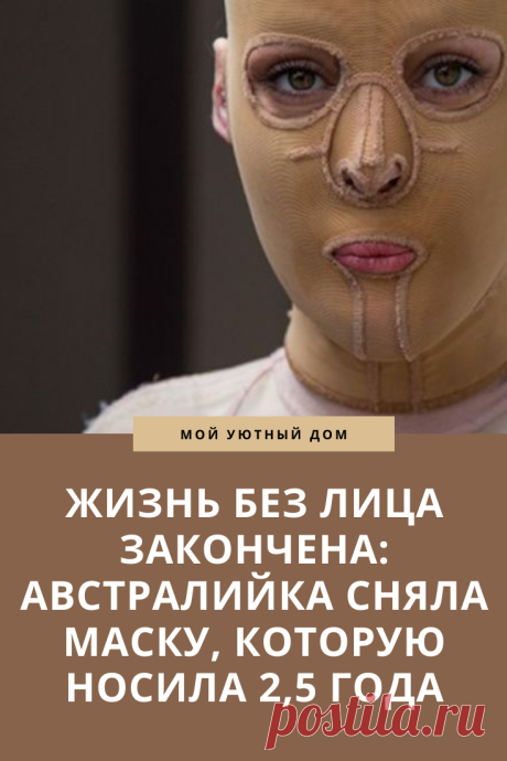 История женщины которая пережила сильные ожоги