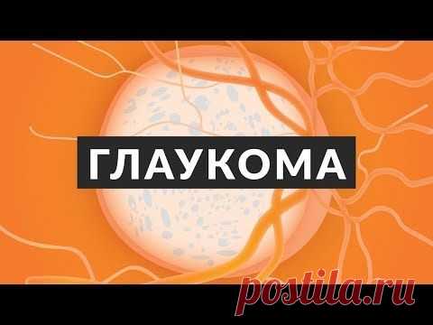 Глаукома — большая группа глазных заболеваний, характеризующаяся постоянным или периодическим повышением внутриглазного давления выше приемлемого для данного человека уровня с последующим развитием типичных дефектов поля зрения, снижением остроты зрения и атрофией зрительного нерва.