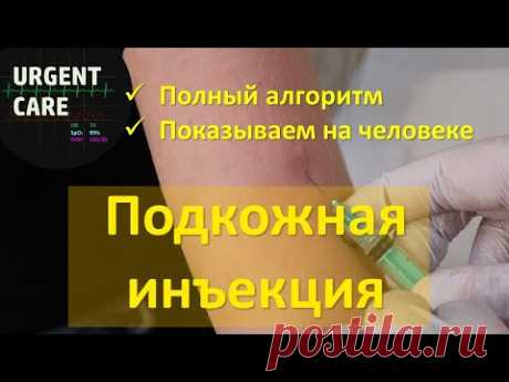 Подкожная инъекция. Техника и алгоритм
