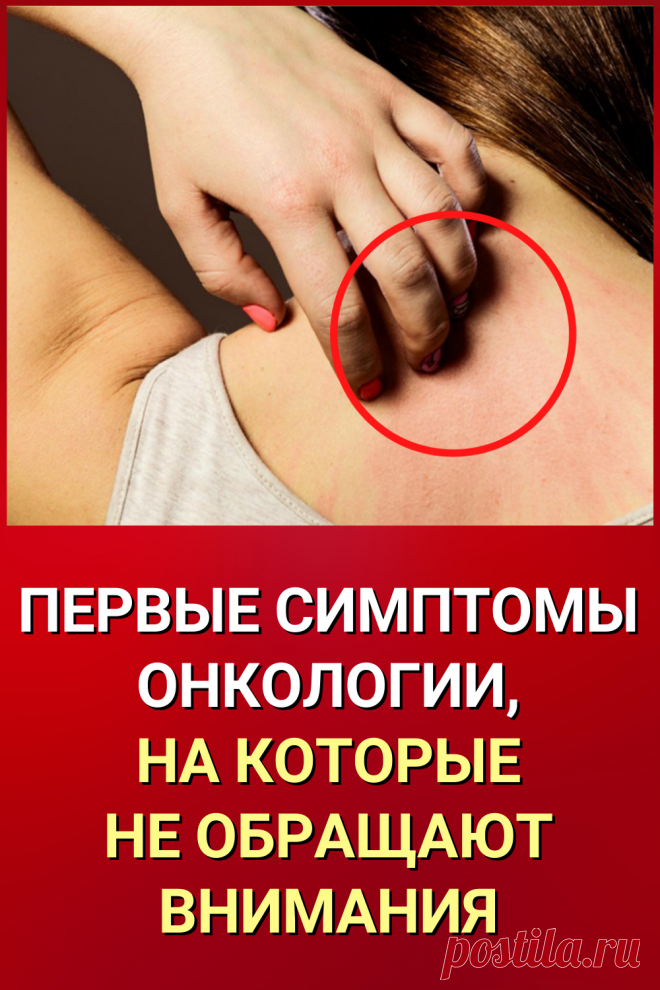 Так есть ли запах у рака? Отвечая на заданный в начале статьи вопрос, есть ли у рака запах, профессор Котан отвечает: "Нет", и добавляет, что речь идёт не о запахе как таковом, а о присутствии молекул веществ, вырабатываемых опухолью и попадающих с током крови в лёгкие, и далее – в выдыхаемый воздух.