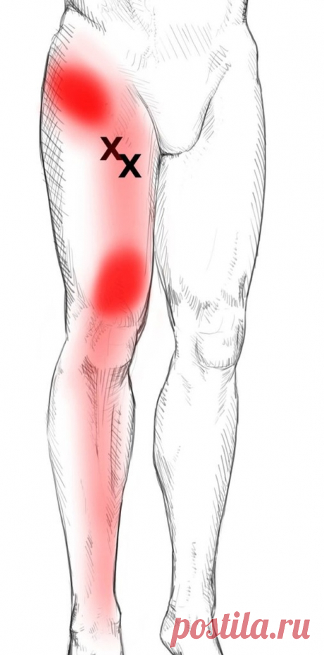 Облегчение боли в приводящих мышцах бедра: самомассаж триггерных точек Статья автора «Йога для начинающих для здоровья» в Дзене ✍:   При дискомфорте в приводящих мышцах бедра, вызванном физической активностью, длительным сидением или другими факторами, самомассаж...