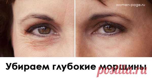 Как эффективно и безболезненно убрать глубокие морщины | Женская страничка
