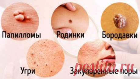 8 Серьезных Заболеваний, о Которых Говорит Наша Кожа