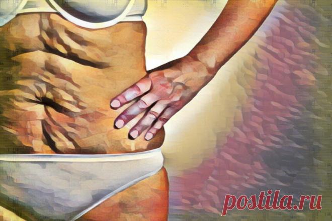 Как омолодить дряблую кожу изнутри | Здоровый Дух | Яндекс Дзен