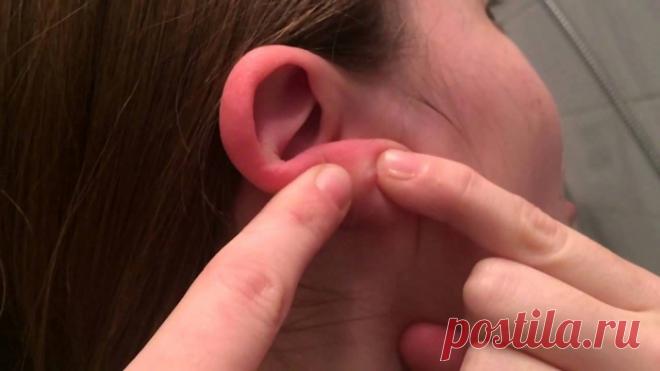 Почему ГНОЯТСЯ УШИ от сережек?