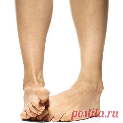 Косточка на большом пальце: как лечить на самом деле / Все для женщины