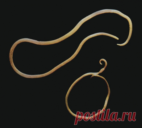 Аскариды: что такое ascaris lumbricoides, симптомы аскаридоза, диагностика, лечение, профилактика