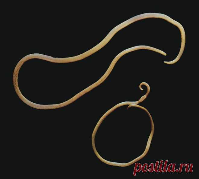 Аскариды: что такое ascaris lumbricoides, симптомы аскаридоза, диагностика, лечение, профилактика