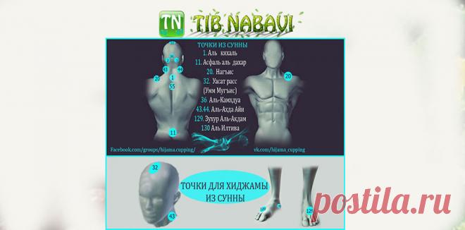 Точки хиджамы из сунны (Атлас точек)