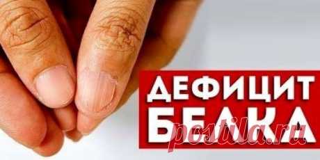Признаки дефицита белка в организме Признаки дефицита белка в... | Интересный контент в группе Домашняя аптечка
