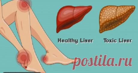 16 предупреждающих признаков того, что ваша печь перегружается токсинами, которые накапливают жиры! Вы должны это знать! Печень выполняет более 400 функций, таких как переработка питательных веществ, разрушение токсинов и алкоголя, переваривание жиров и
