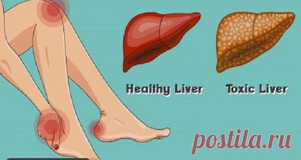 16 предупреждающих признаков того, что ваша печь перегружается токсинами, которые накапливают жиры! Вы должны это знать! Печень выполняет более 400 функций, таких как переработка питательных веществ, разрушение токсинов и алкоголя, переваривание жиров и