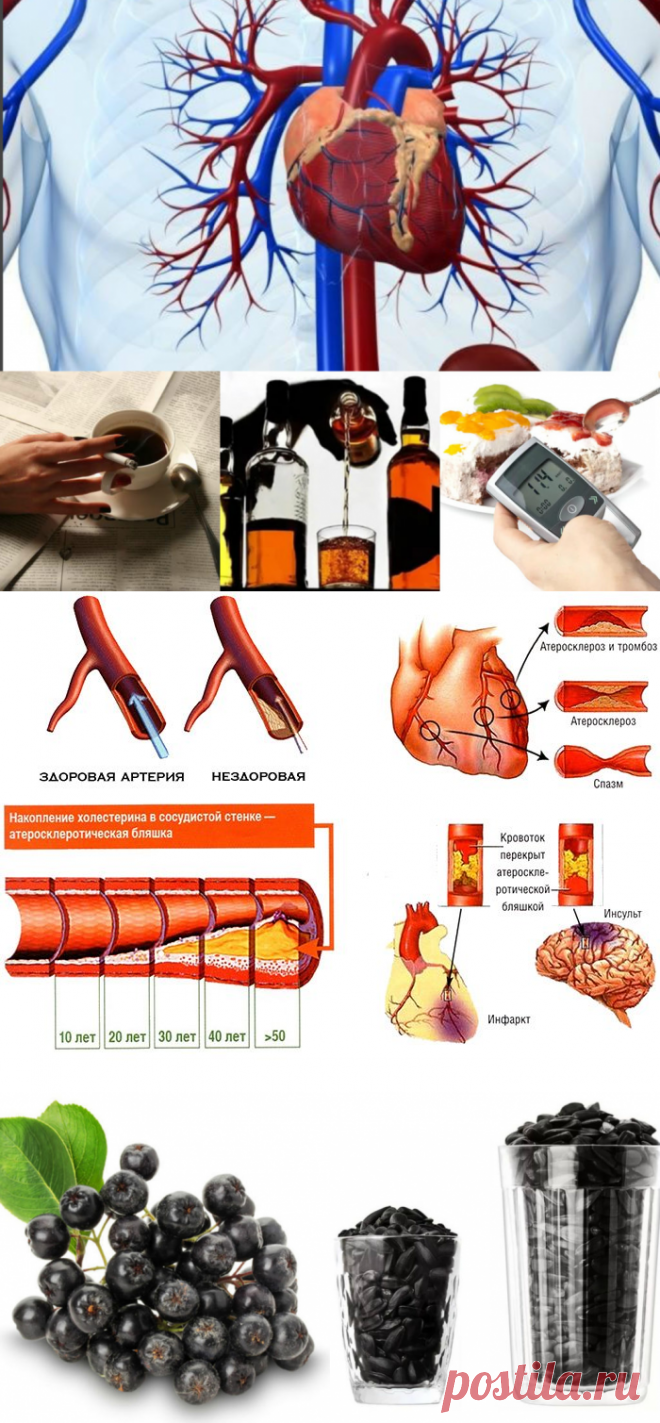 Атеросклероз сердца - что это такое, симптомы и лечение