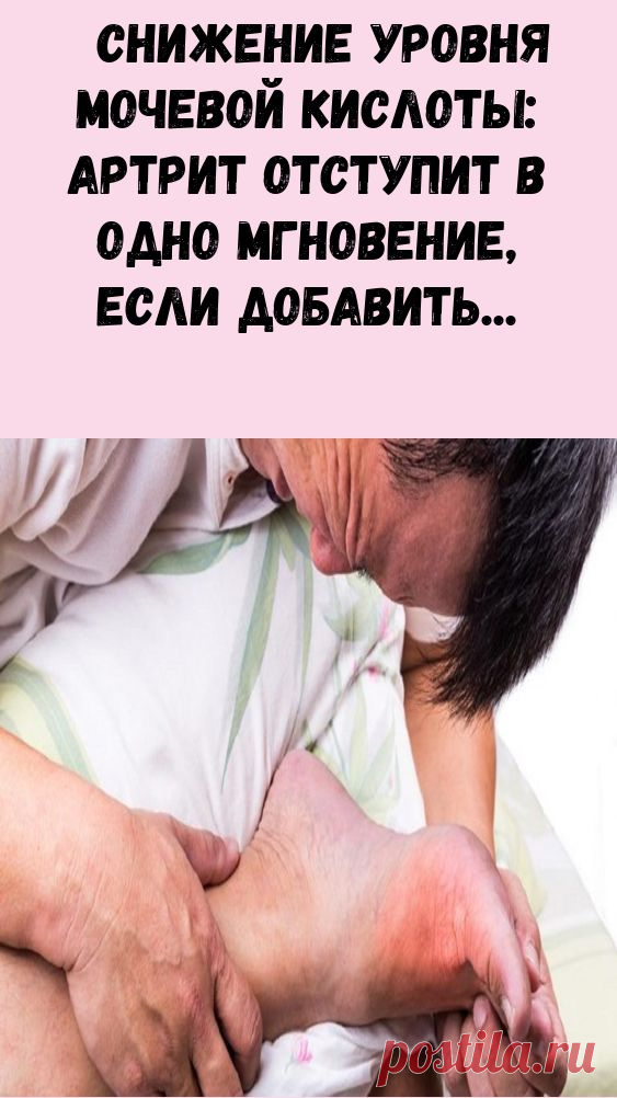 Снижение уровня мочевой кислоты: артрит отступит в одно мгновение, если добавить в свой рацион…