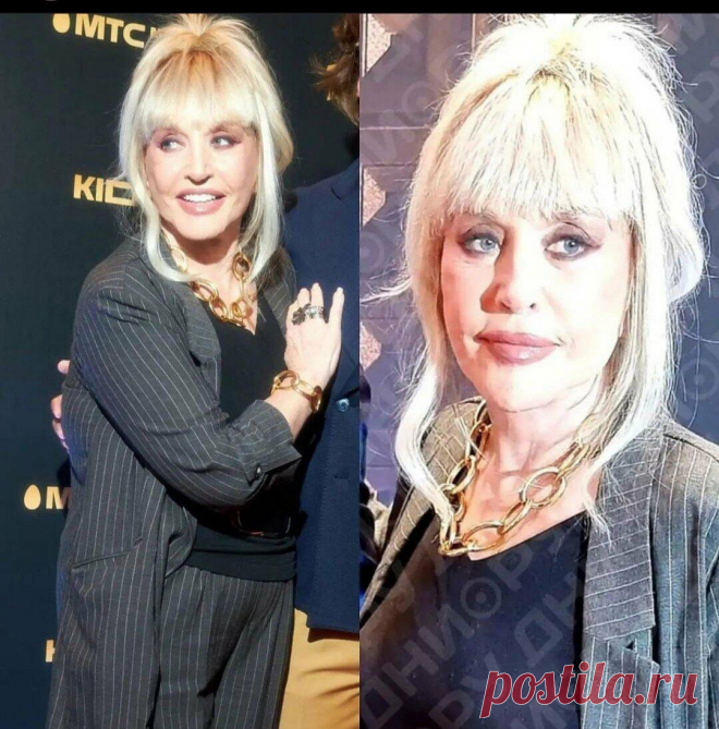 У Аллы Борисовны в 72 года изменилось лицо (по моему личному восприятию)
Добрый день, читатели блога! У Аллы Борисовны в 72 года изменилось лицо. По моему личному восприятию. На одном из светских мероприятий Примадонна предстала в новом облике — с собранными волосами, пухлыми губами, распахнутыми глазами. фото с сайта дни.ру фото с сайта дни.ру Овал лица у певицы стал более выраженным, подтянутый. Носик аккуратный. Веки не обвисшие, […]
Читай дальше на сайте. Жми подробнее ➡