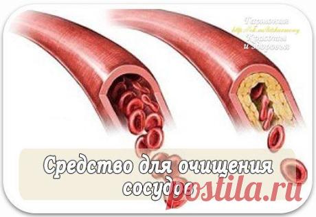 Средство для очищения сосудов.