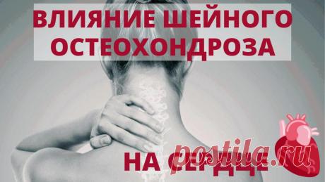 Влияние шейного остеохондроза на сердце
Как влияет шейный остеохондроз на сердце? Представьте головной мозг. Это орган, который, очень любит кислород. Сосудистый центр мозга, регулирующий деятельность сердца, питается из позвоночных артерий, которые отходят из аорты через брахиоцефальный ствол путем сложных ответвлений. Проходят они сквозь отверстия поперечных отростков позвонков и заходят в...
Читай дальше на сайте. Жми подробнее ➡